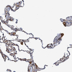 Immunohistochemical staining of human lung shows strong membranous positivity in macrophages.