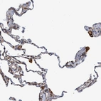 Immunohistochemical staining of human lung shows strong membranous positivity in macrophages.