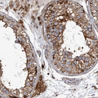 Immunohistochemical staining of human testis shows strong membranous positivity in cells in seminiferous ducts.