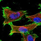Immunofluorescent staining of human cell line U-251 MG shows localization to plasma membrane.