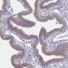 Immunohistochemical staining of human Fallopian tube shows weak to moderate cytoplasmic positivity in glandular cells.