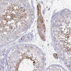 Immunohistochemical staining of human testis shows weak to moderate cytoplasmic positivity in Leydig cells and in cells in seminifereus ducts.