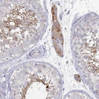 Immunohistochemical staining of human testis shows weak to moderate cytoplasmic positivity in Leydig cells and in cells in seminifereus ducts.