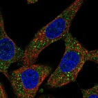 Immunofluorescent staining of human cell line A549 shows localization to cytosol.