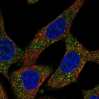Immunofluorescent staining of human cell line A549 shows localization to cytosol.