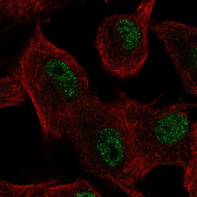 Anti-SLC39A11 Antibody