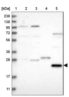 Lane 1: Marker [kDa] 230, 130, 95, 72, 56, 36, 28, 17, 11_br/_Lane 2: Human cell line RT-4_br/_Lane 3: Human cell line U-251MG sp_br/_Lane 4: Human plasma (IgG/HSA depleted)_br/_Lane 5: Human liver tissue