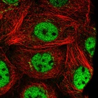 Immunofluorescent staining of human cell line A-431 shows localization to nucleoplasm & the Golgi apparatus.