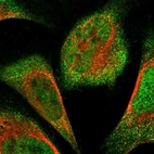 Immunofluorescent staining of human cell line U-2 OS shows localization to nucleoplasm & cytosol.