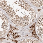 Anti-SEC14L1 Antibody