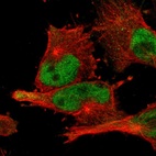 Immunofluorescent staining of human cell line U-251 MG shows localization to nucleoplasm.