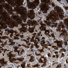 Anti-HSD17B14 Antibody