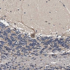 Immunohistochemical staining of human cerebellum shows moderate granular cytoplasmic positivity in Purkinje cells.