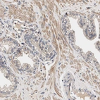 Immunohistochemical staining of human prostate shows moderate cytoplasmic positivity in smooth muscle cells.