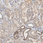 Immunohistochemical staining of human kidney shows weak to moderate granular cytoplasmic positivity in cells in tubules.