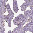 Immunohistochemical staining of human fallopian tube shows high expression.