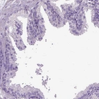 Immunohistochemical staining of human prostate shows low expression as expected.
