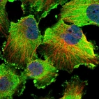 Immunofluorescent staining of human cell line U-251 MG shows localization to plasma membrane & cytosol.