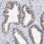 Anti-GMPR Antibody