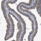 Immunohistochemical staining of human fallopian tube shows moderate cytoplasmic positivity in glandular cells.