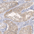 Immunohistochemical staining of human testis shows moderate cytoplasmic positivity in cells in seminiferous ducts.