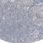 Immunohistochemical staining of human tonsil shows no cytoplasmic positivity in non-germinal center cells as expected.