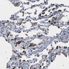 Immunohistochemical staining of human lung shows strong cytoplasmic positivity in pneumocytes.