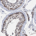 Immunohistochemical staining of human testis shows strong cytoplasmic positivity in cells in seminiferous ducts.