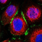 Immunofluorescent staining of human cell line A-431 shows localization to plasma membrane & cell junctions.