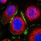 Immunofluorescent staining of human cell line A-431 shows localization to plasma membrane & cell junctions.