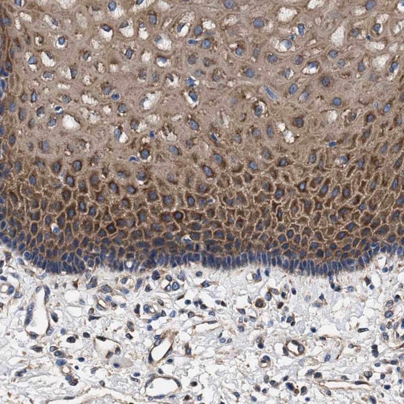 Anti-SH3GL1 Antibody