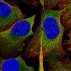 Immunofluorescent staining of human cell line U-2 OS shows localization to cytosol.