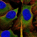 Immunofluorescent staining of human cell line U-2 OS shows localization to cytosol.