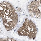 Anti-WIPI2 Antibody