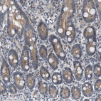 Immunohistochemical staining of human duodenum shows moderate cytoplasmic positivity in glandular cells.
