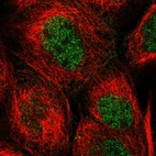 Immunofluorescent staining of human cell line A-431 shows localization to nucleoplasm.