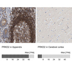 Anti-PRKD2 Antibody