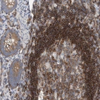Immunohistochemical staining of human appendix shows high expression.