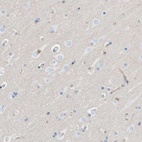 Immunohistochemical staining of human cerebral cortex shows low expression as expected.