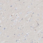 Anti-PRKD2 Antibody