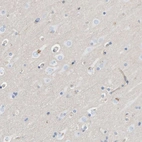 Immunohistochemical staining of human cerebral cortex shows low expression as expected.