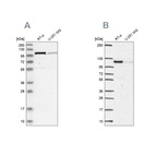 Anti-PRKD2 Antibody