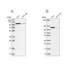 Western blot analysis using Anti-PRKD2 antibody HPA021490 (A) shows similar pattern to independent antibody HPA056727 (B).