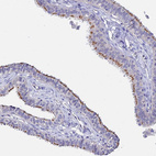 Anti-APOBEC3H Antibody