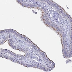 Anti-APOBEC3H Antibody
