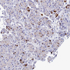 Immunohistochemical staining of human pancreas shows strong cytpoplasmic granular positivity in a subset of exocrine glandular cells.