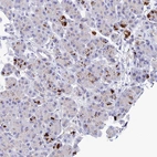 Immunohistochemical staining of human pancreas shows strong cytpoplasmic granular positivity in a subset of exocrine glandular cells.