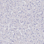 Immunohistochemical staining of human liver shows no positivity in hepatocytes as expected.