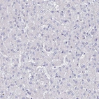 Immunohistochemical staining of human liver shows no positivity in hepatocytes as expected.