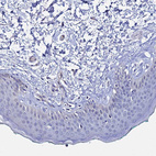 Immunohistochemical staining of human skin shows no positivity in squamous epithelial cells as expected.